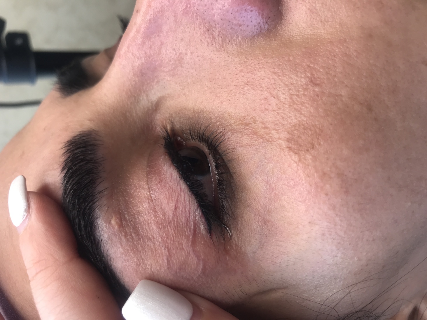 بن مژه نیلا حنیفی