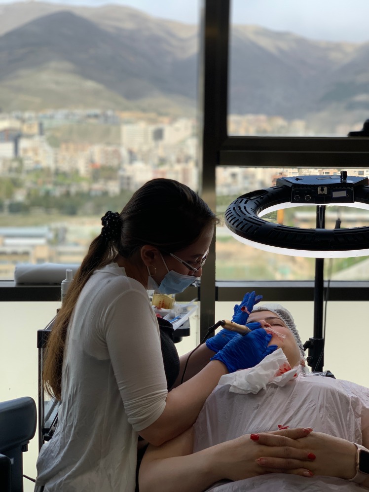 مراقبتهای بعد از تاتو بدن