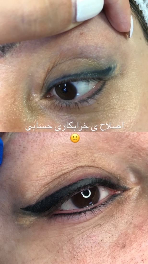 اصلاح خط چشم نیلا حنیفی